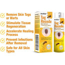 🪔Diwali Sale 50%+ OFF Bee Venom Wart Remover Spray 30ml Buy 1 Get 1 Free!!😍