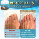 5X Quick-healing Nail Fungus Ointment  BUY 1 GET 1 FREE 🔥