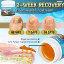 5X Quick-healing Nail Fungus Ointment  BUY 1 GET 1 FREE 🔥