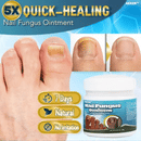 5X Quick-healing Nail Fungus Ointment  BUY 1 GET 1 FREE 🔥