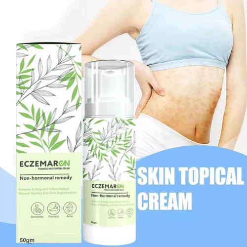 Eczemaron™️Anti Fungal Spray [BUY 1 GET 1 FREE!🔥]  On Sale 🔥