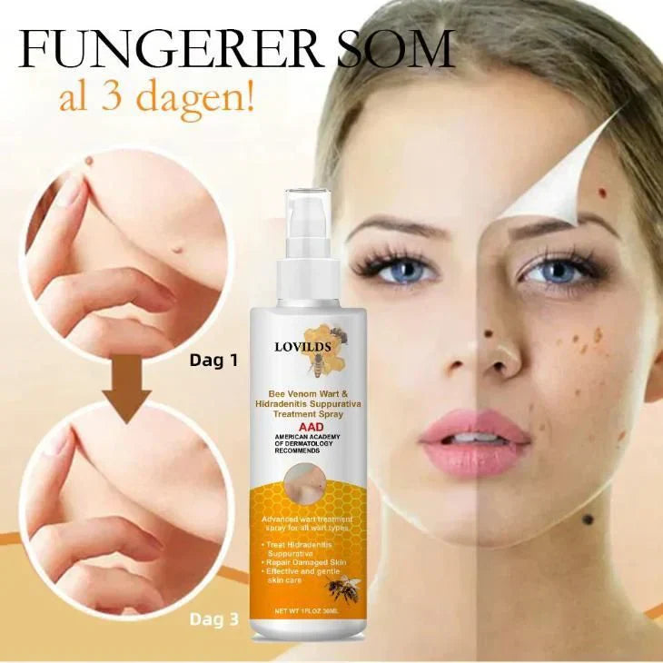🪔Diwali Sale 50%+ OFF Bee Venom Wart Remover Spray 30ml Buy 1 Get 1 Free!!😍