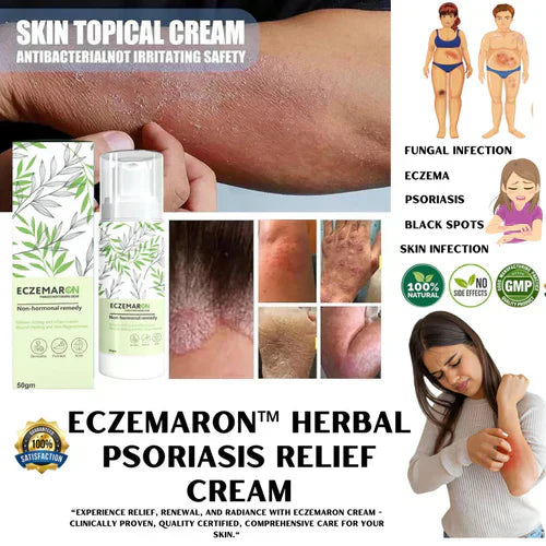 Eczemaron™️Anti Fungal Spray [BUY 1 GET 1 FREE!🔥]  On Sale 🔥