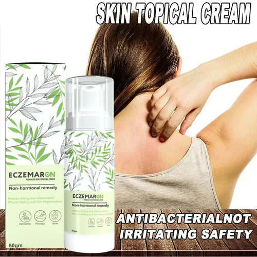 Eczemaron™️Anti Fungal Spray [BUY 1 GET 1 FREE!🔥]  On Sale 🔥