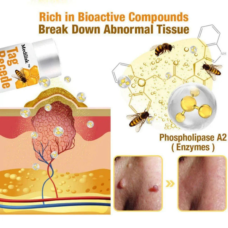 🪔Diwali Sale 50%+ OFF Bee Venom Wart Remover Spray 30ml Buy 1 Get 1 Free!!😍