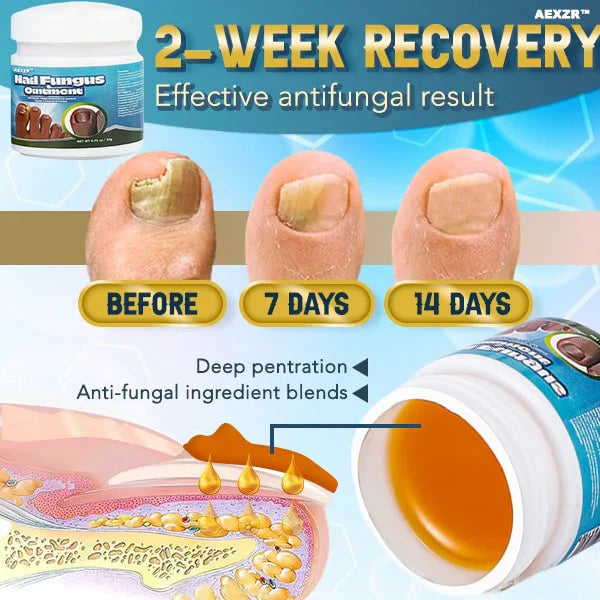 5X Quick-healing Nail Fungus Ointment  BUY 1 GET 1 FREE 🔥