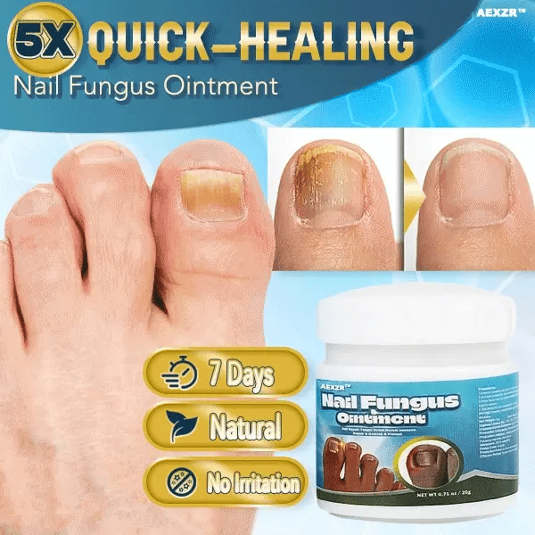 5X Quick-healing Nail Fungus Ointment (Pack of 2)